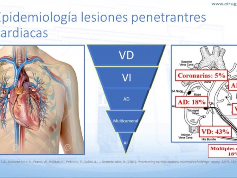 Diapositiva 5 de Trauma penetrante cardíaco