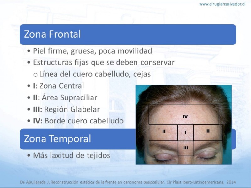 Diapositiva 15 de Tipos de Reconstrucción Facial