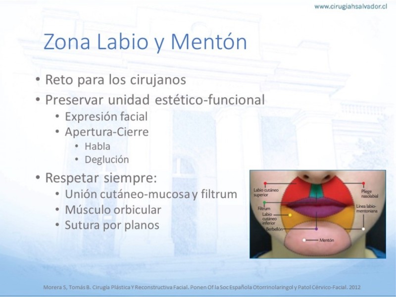 Diapositiva 35 de Tipos de Reconstrucción Facial