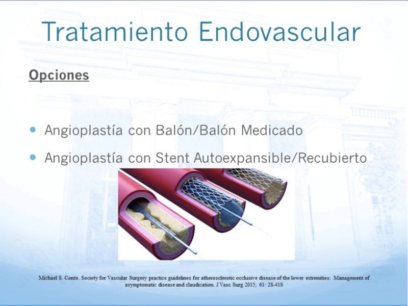 Diapositiva 13 de Tratamiento Endovascular de EAO Femoro-Distal