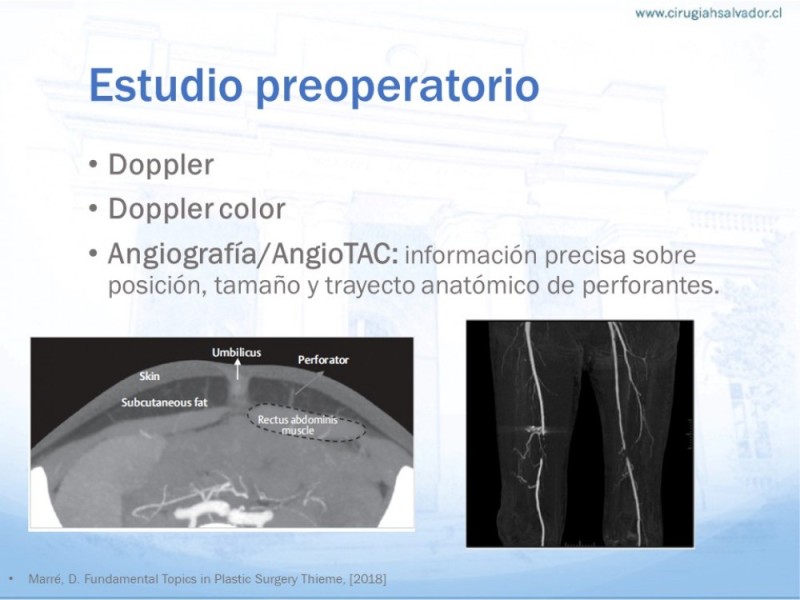 Diapositiva 7 de Colgajos MicroquirúrgicosColgajos Microquirúrgicos