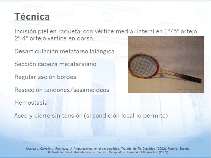 Diapositiva 7 de Técnica Quirúrgica Amputaciones Menores