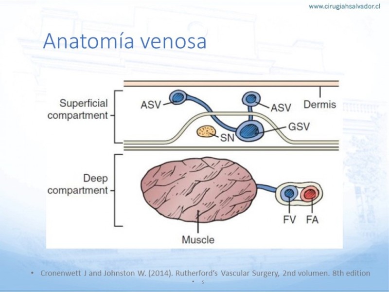 Diapositiva 3 de Safenectomía: Técnica y resultados a largo plazo