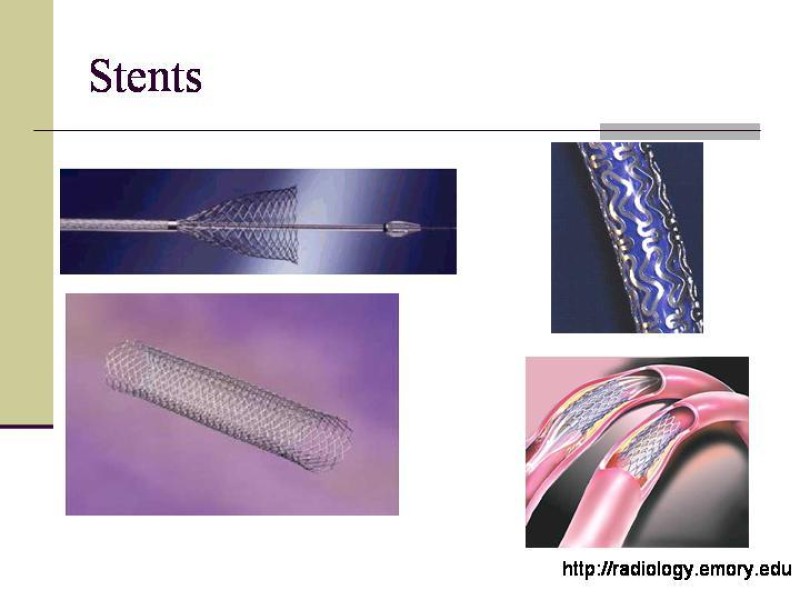 Diapositiva 22 de Tratamiento Endovascular de la Enfermedad Aortoilíaca