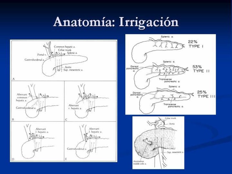 Diapositiva 10 de Trauma Pancreato-duodenal