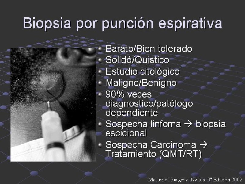 Diapositiva 16 de Estudio de Masas Cervicales