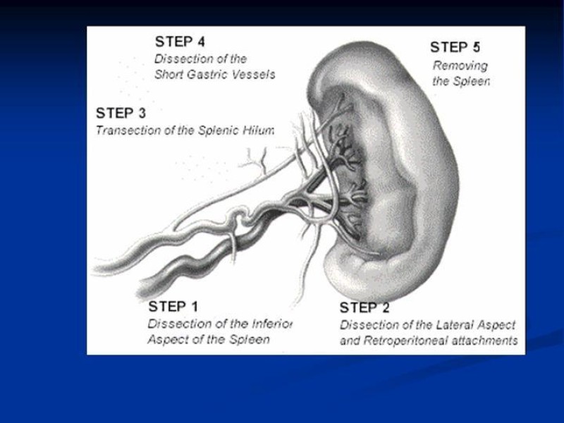 Diapositiva 20 de Trauma Esplénico