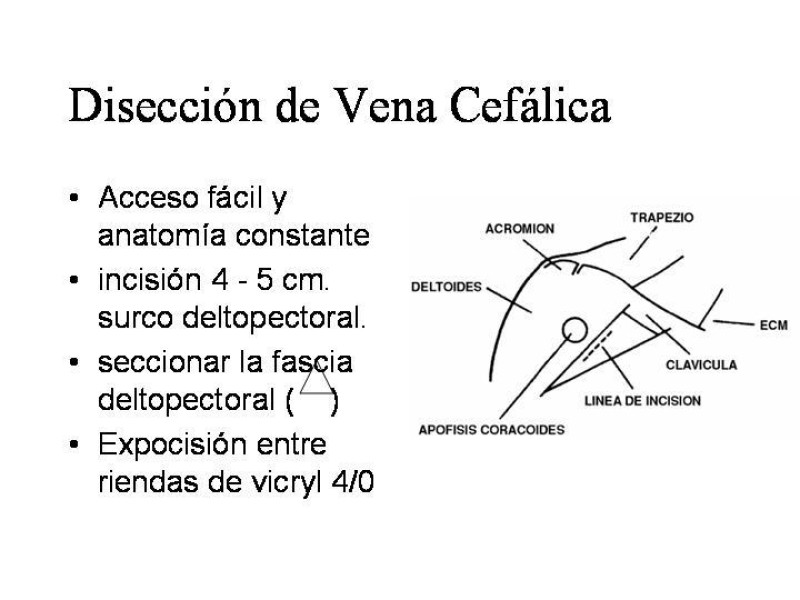 Diapositiva 5 de Catéter de Quimioterapia