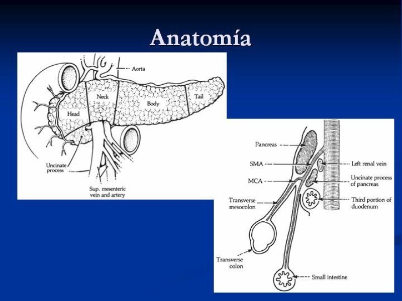 Diapositiva 7 de Trauma Pancreato-duodenal