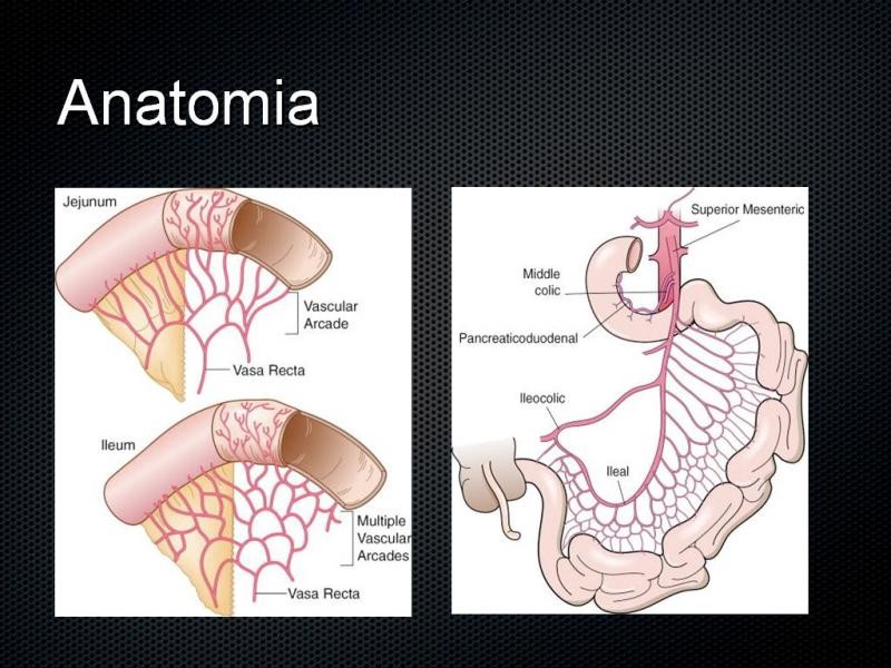 Diapositiva 3 de Tumores de Intestino Delgado