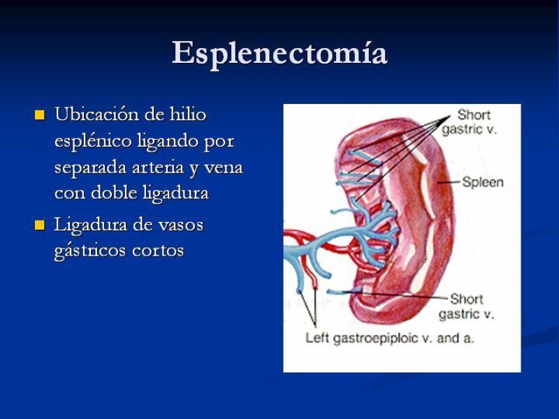 Diapositiva 19 de Trauma Esplénico