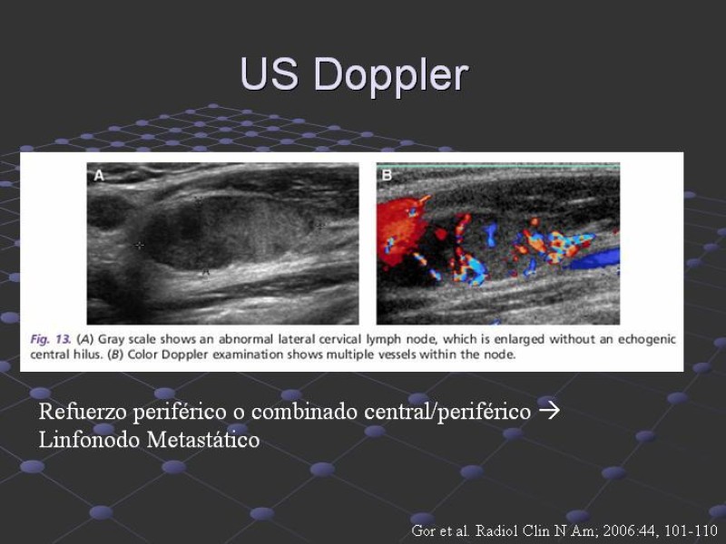 Diapositiva 20 de Estudio de Masas Cervicales
