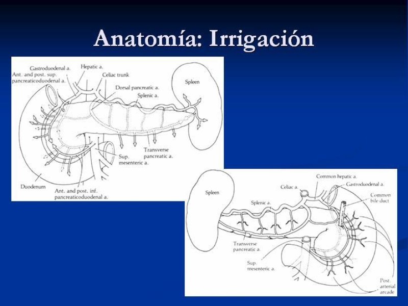 Diapositiva 9 de Trauma Pancreato-duodenal