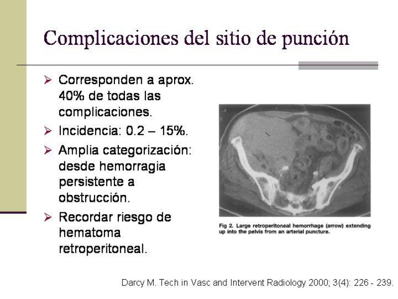 Diapositiva 40 de Tratamiento Endovascular de la Enfermedad Aortoilíaca