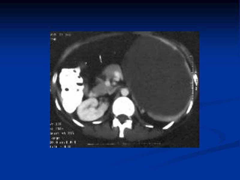 Diapositiva 8 de Trauma Esplénico