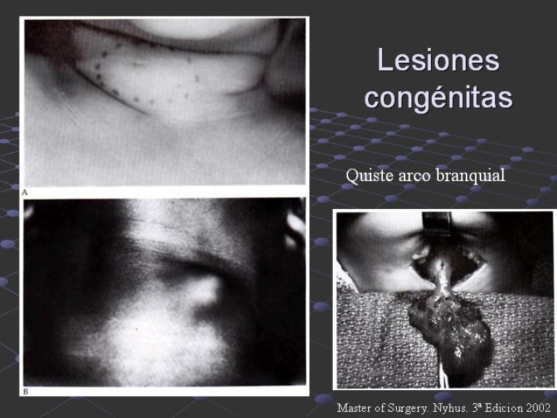 Diapositiva 6 de Estudio de Masas Cervicales