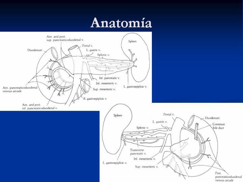 Diapositiva 11 de Trauma Pancreato-duodenal