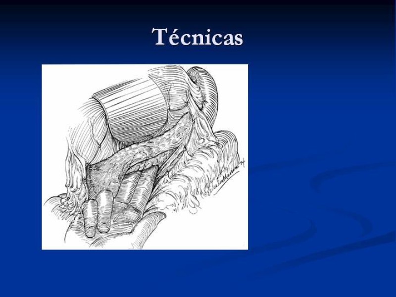 Diapositiva 30 de Trauma Pancreato-duodenal