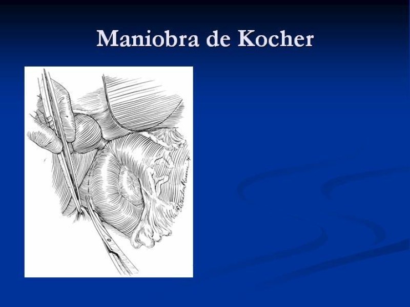 Diapositiva 24 de Trauma Pancreato-duodenal