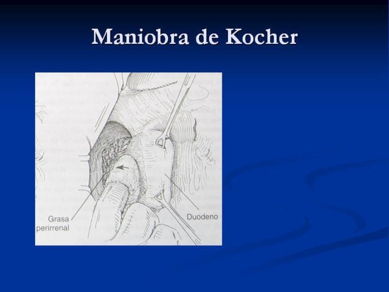 Diapositiva 23 de Trauma Pancreato-duodenal