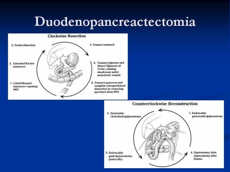 Diapositiva 38 de Trauma Pancreato-duodenal