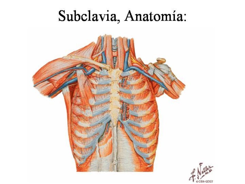 Diapositiva 7 de Catéter de Quimioterapia