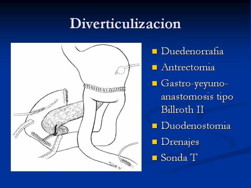 Diapositiva 36 de Trauma Pancreato-duodenal