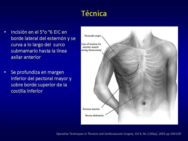 Diapositiva 5 de Toracotomías