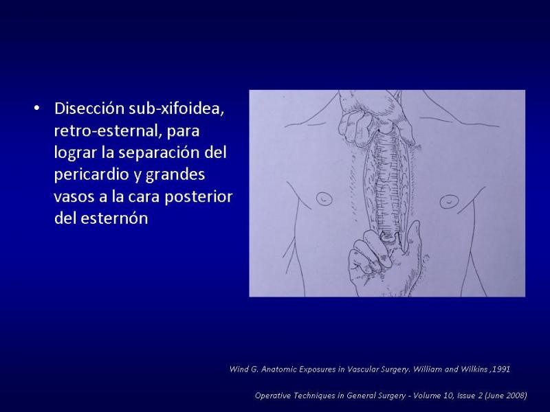 Diapositiva 17 de Toracotomías
