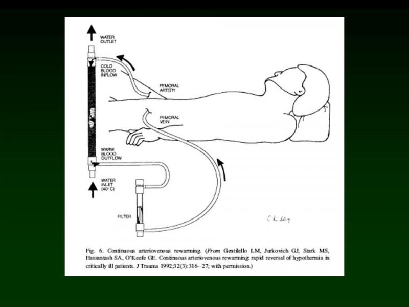 Diapositiva 26 de Trauma: Damage Control