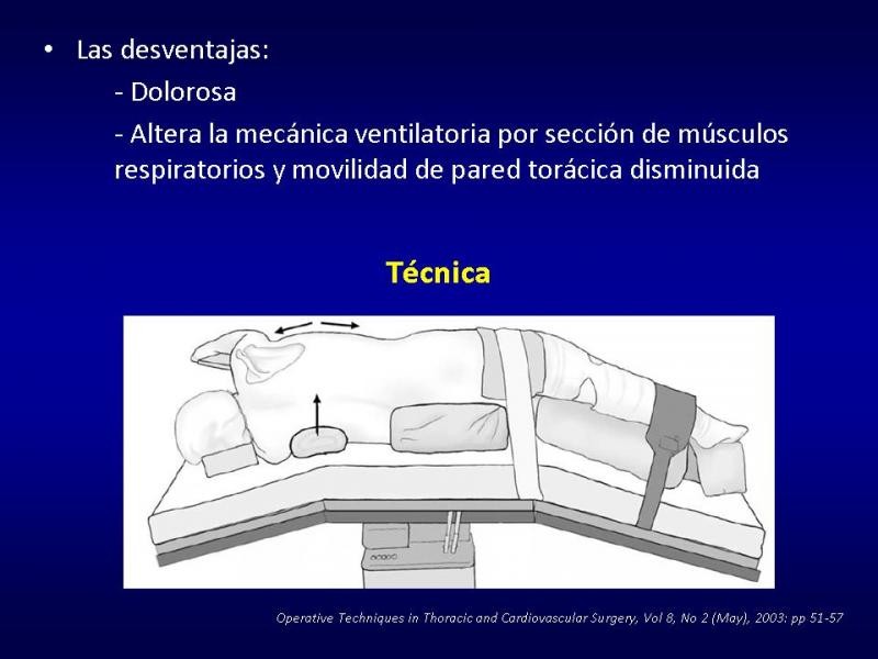Diapositiva 12 de Toracotomías