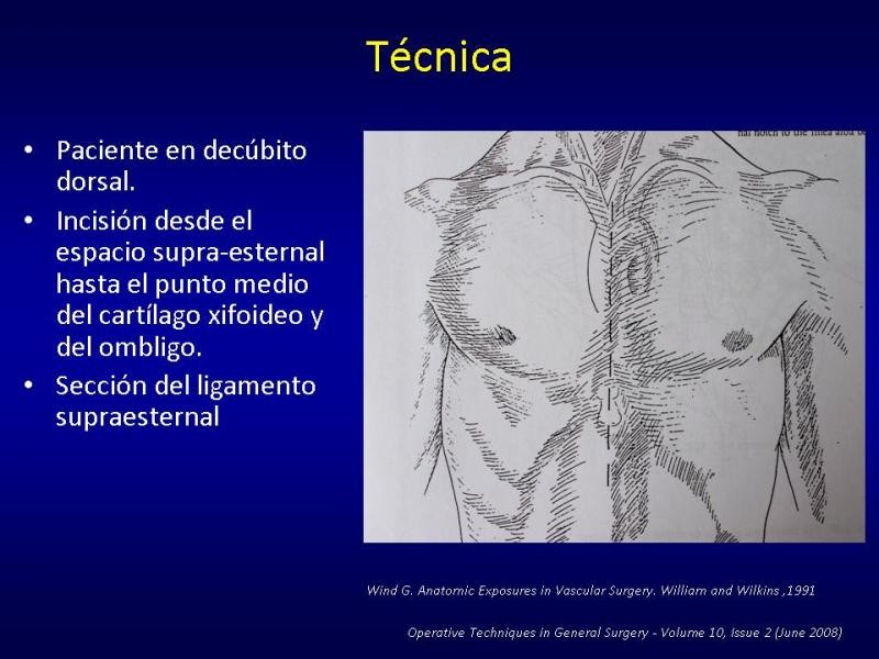 Diapositiva 16 de Toracotomías