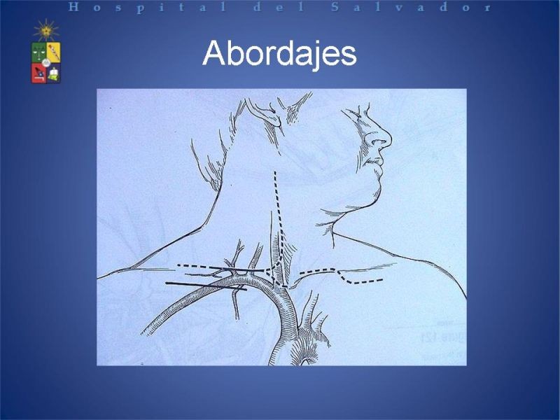 Diapositiva 9 de Trauma Vascular Cervical