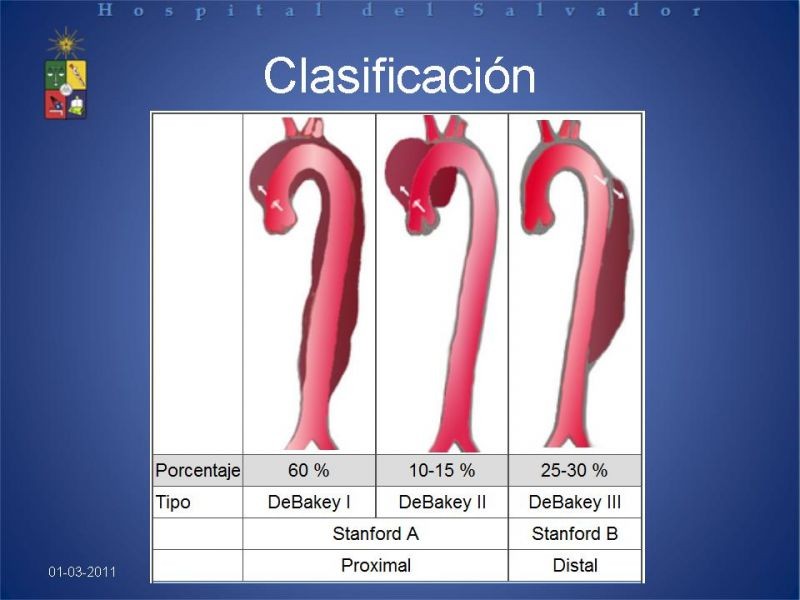 Diapositiva 2 de Manejo Disección Aórtica Tipo B