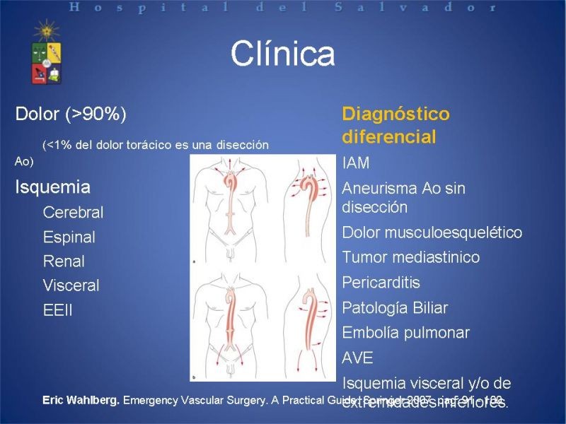 Diapositiva 6 de Manejo Disección Aórtica Tipo B