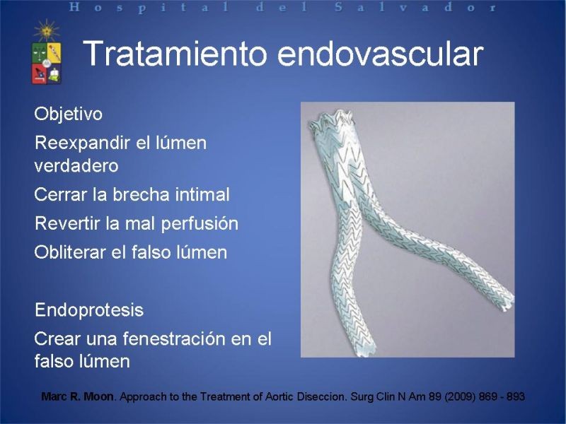Diapositiva 13 de Manejo Disección Aórtica Tipo B