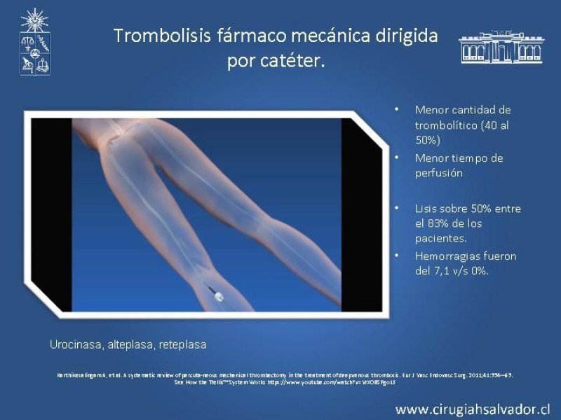 Diapositiva 16 de Manejo Quirúrgico de la TVP