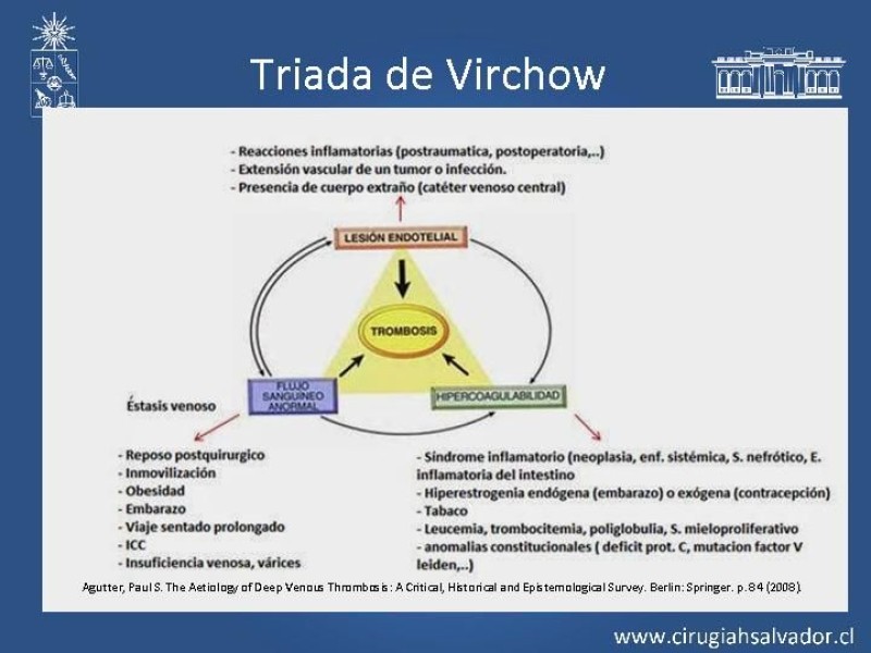 Diapositiva 4 de Manejo Quirúrgico de la TVP