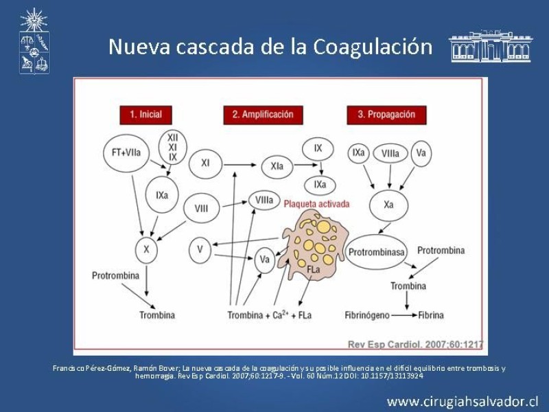 Diapositiva 5 de Manejo Quirúrgico de la TVP
