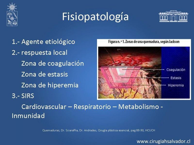 Diapositiva 4 de Gran Quemado Manejo Primeras 24 hrs