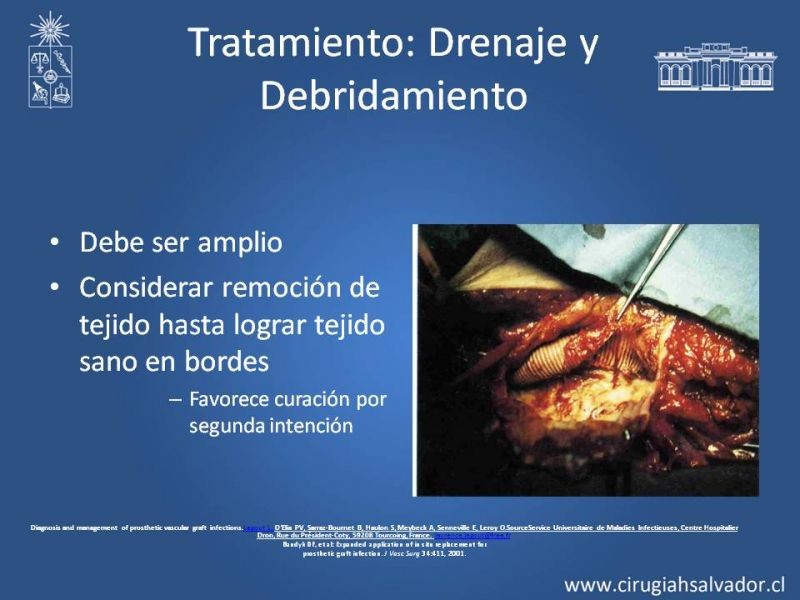 Diapositiva 26 de Infección de prótesis vasculares 