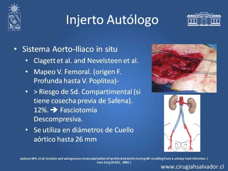 Diapositiva 35 de Infección de prótesis vasculares 