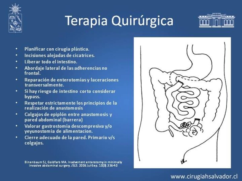 Diapositiva 19 de Fistulas Intestinales