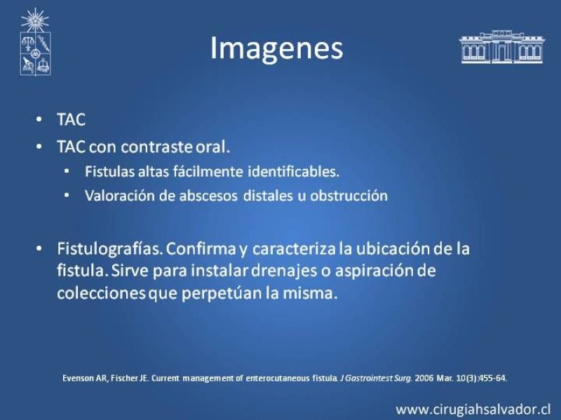 Diapositiva 13 de Fistulas Intestinales