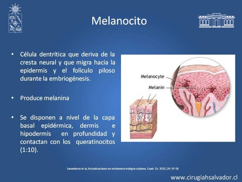 Diapositiva 1 de Estudio, diagnóstico y clasificación del Melanoma
