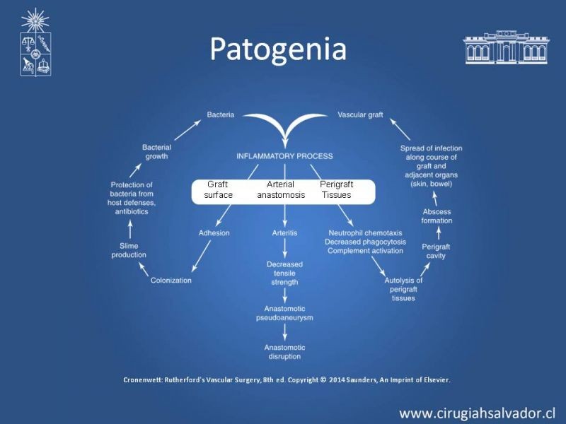 Diapositiva 6 de Infección de prótesis vasculares 
