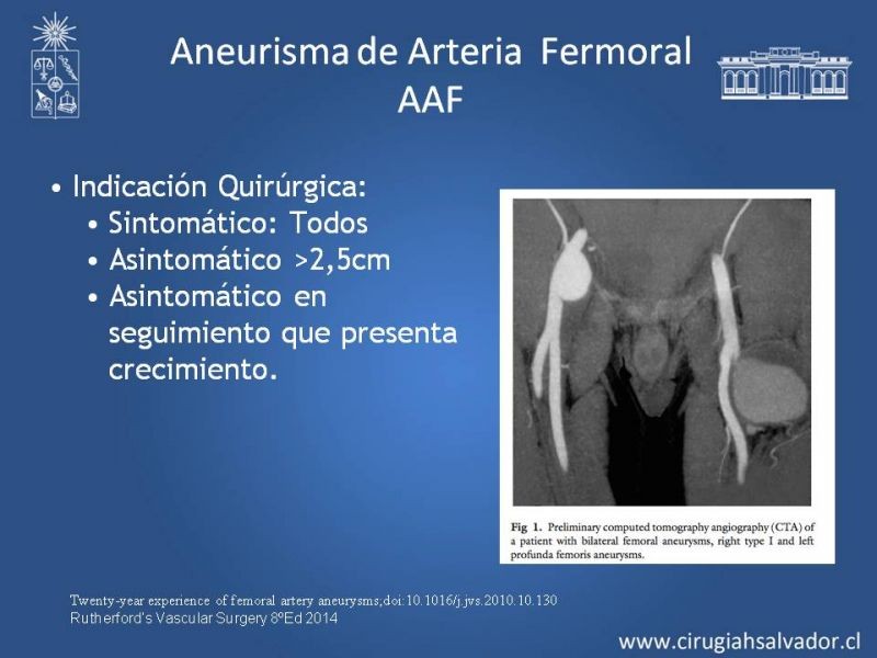 Diapositiva 26 de Aneurismas Periféricos