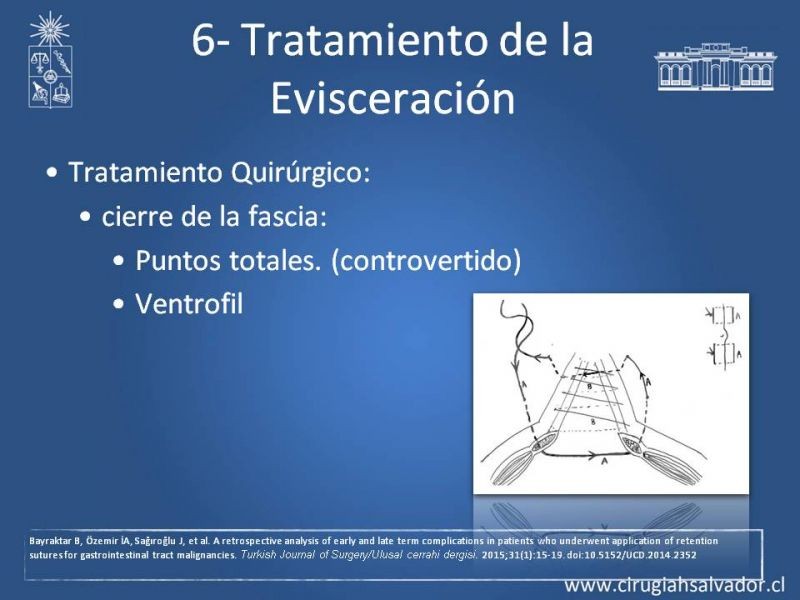 Diapositiva 25 de Manejo de la Evisceración