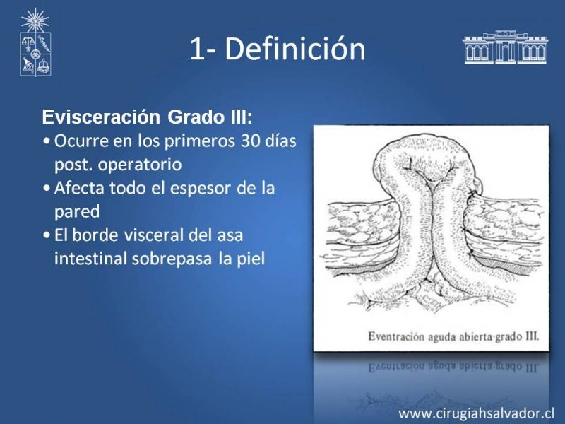 Diapositiva 8 de Manejo de la Evisceración