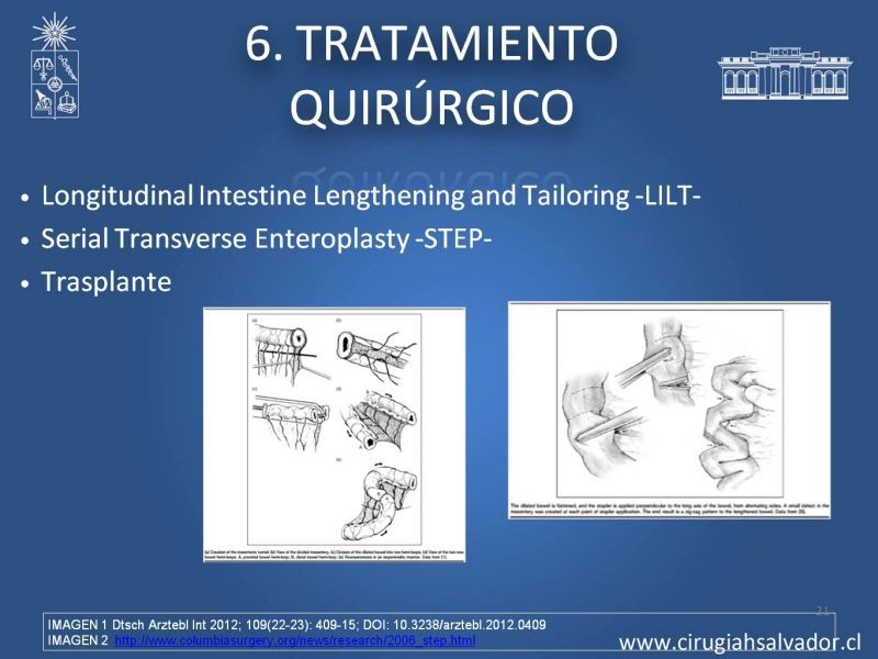 Diapositiva 20 de Sindrome intestino corto